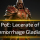 Lacerate of Haemorrhage Gladiator - Path of Exile 3.24